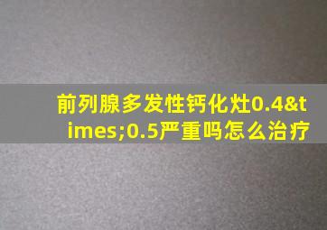 前列腺多发性钙化灶0.4×0.5严重吗怎么治疗