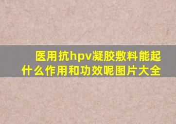 医用抗hpv凝胶敷料能起什么作用和功效呢图片大全